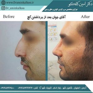 جراح بینی اصفهان