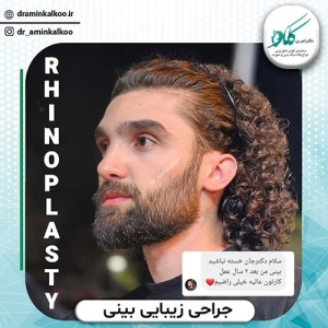 بینی-123