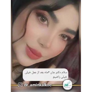 بینی-129