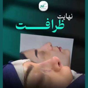 بینی-132