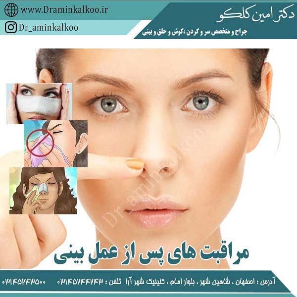 مراقبت های بعد از جراحی بینی