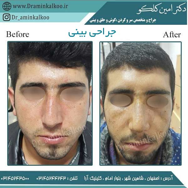 بهترین جراح بینی
