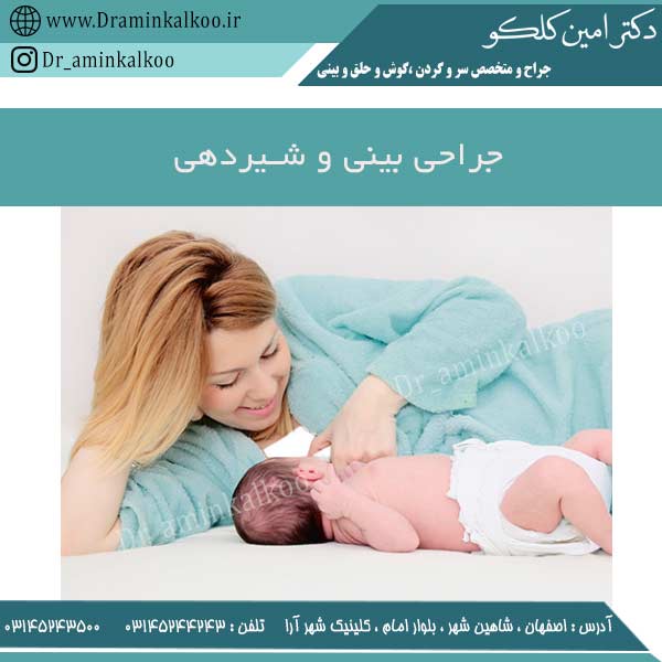 جراحی بینی و شیردهی