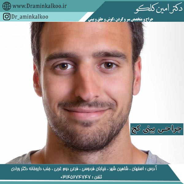 جراحی بینی کج - دکتر امین کلکو