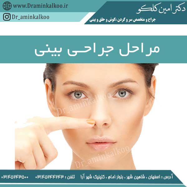 مراحل جراحی بینی
