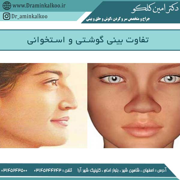 تفاوت بینی گوشتی و استخوانی
