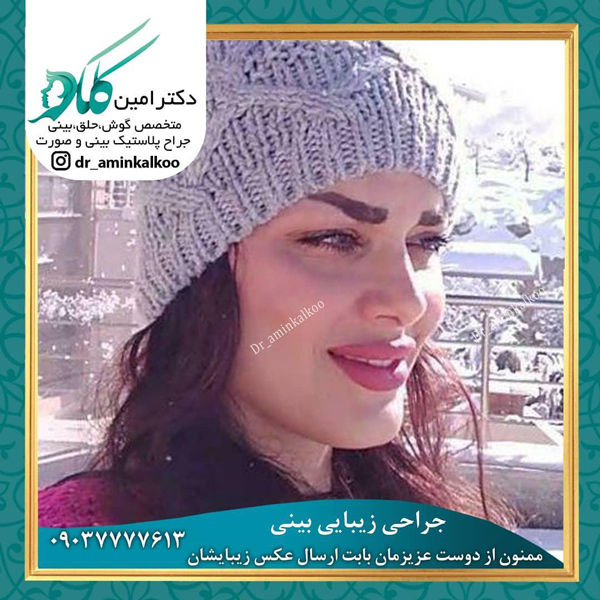 جراحی بینی-دکتر کلکو