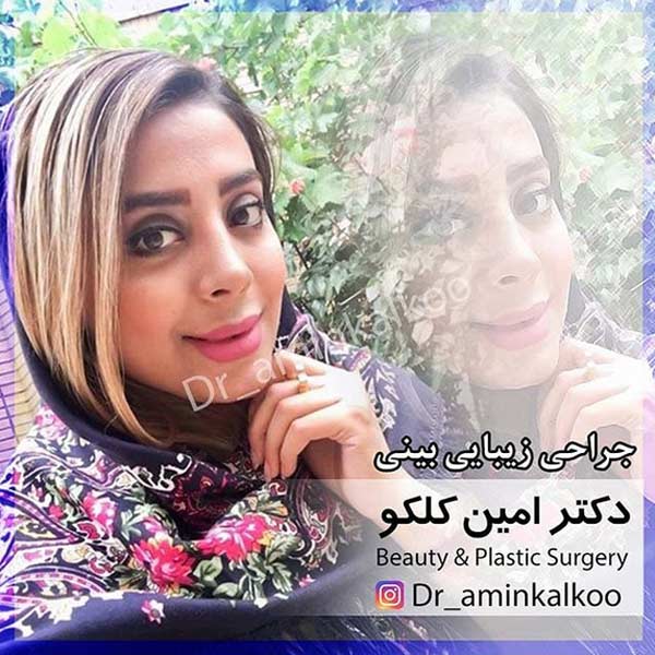 جراحی بینی-دکتر کلکو
