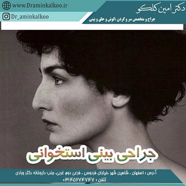 عکس بینی استخوانی - جراحی بینی استخوانی