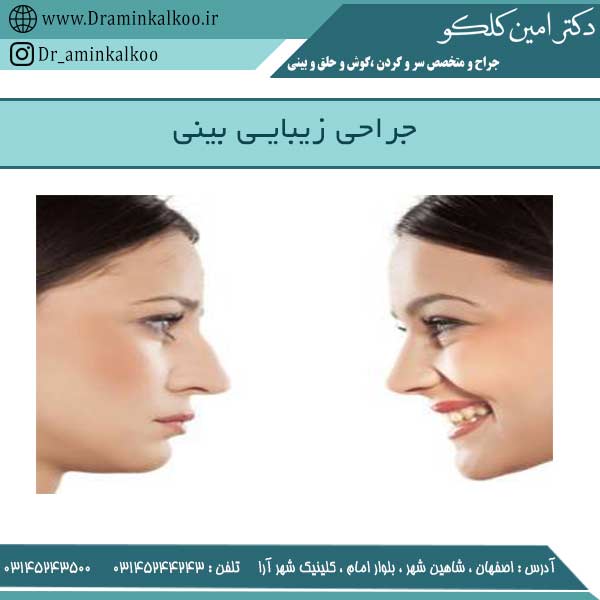 جراحی زیبایی بینی