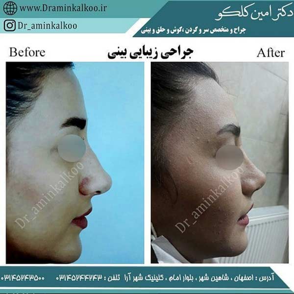 بهترین جراح بینی