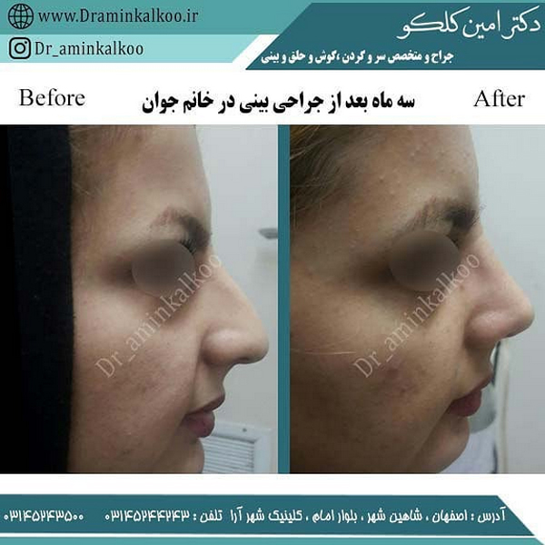 بهترین جراح بینی