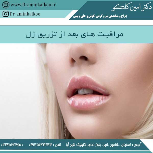 مراقبت های بعد از تزریق ژل