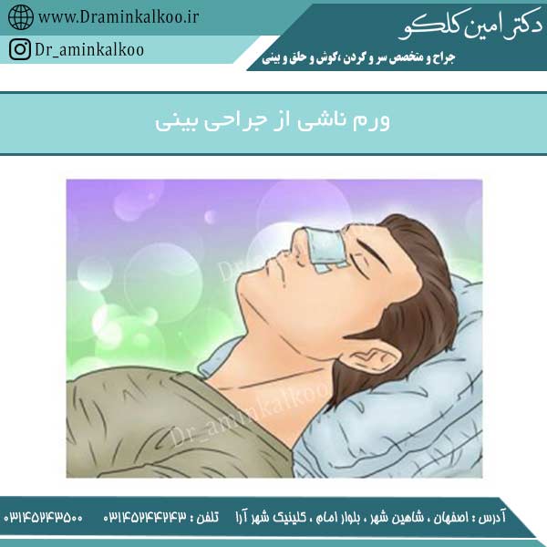 ورم ناشی از جراحی بینی
