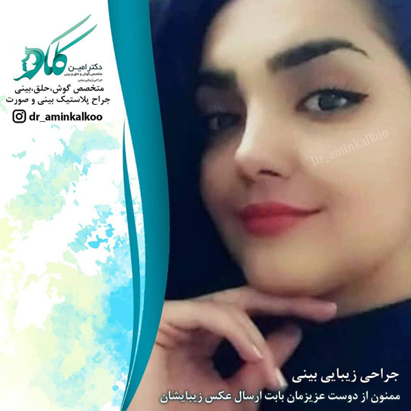 بهترین جراح بینی