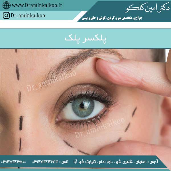 پلکسر پلک