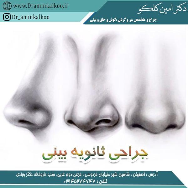 عکس جراحی ترمیمی بینی