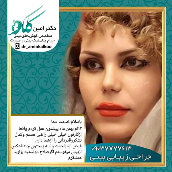 جراحی بینی در بانوان