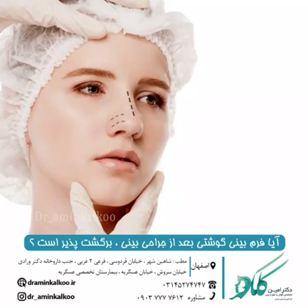 عکس جراحی بینی گوشتی