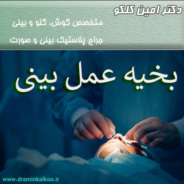 بخیه عمل بینی - دکتر امین کلکو