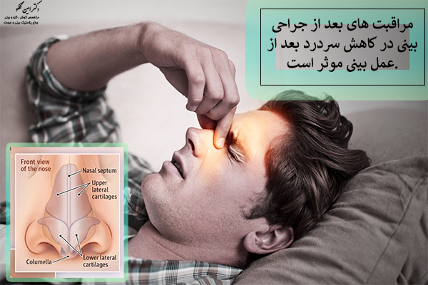 سردرد بعد از جراحی بینی - دکتر امین کلکو