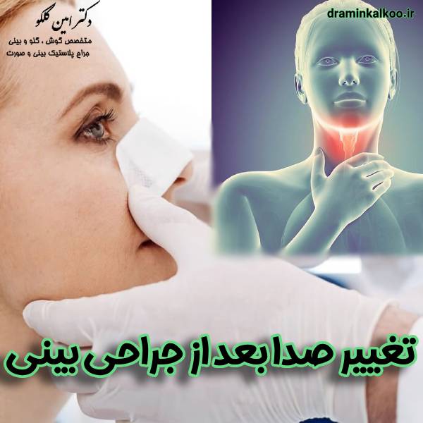 تغییر صدا بعد از جراحی بینی - دکتر امین کلکو