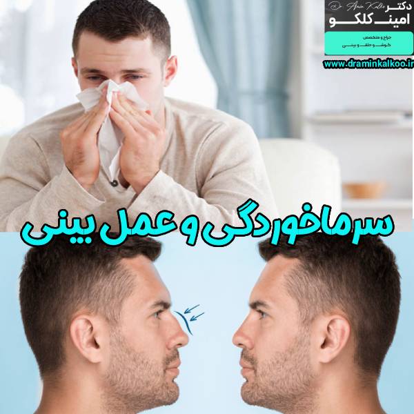 سرماخوردگی و عمل بینی - دکتر امین کلکو