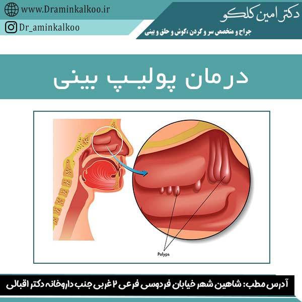 درمان پولیپ بینی - دکتر امین کلکو