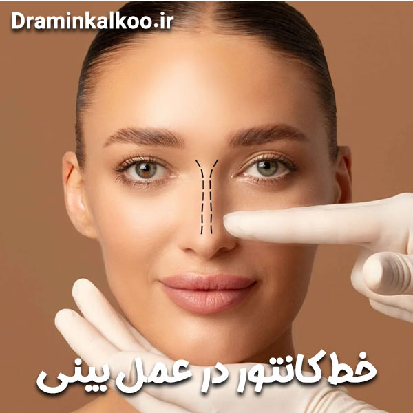 خط کانتور در عمل بینی
